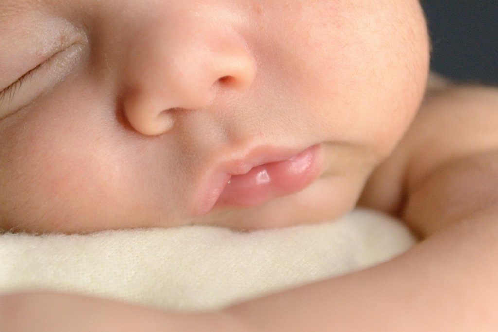 Acantosis Nigricans en niños: qué es, causas, síntomas y cómo tratarla