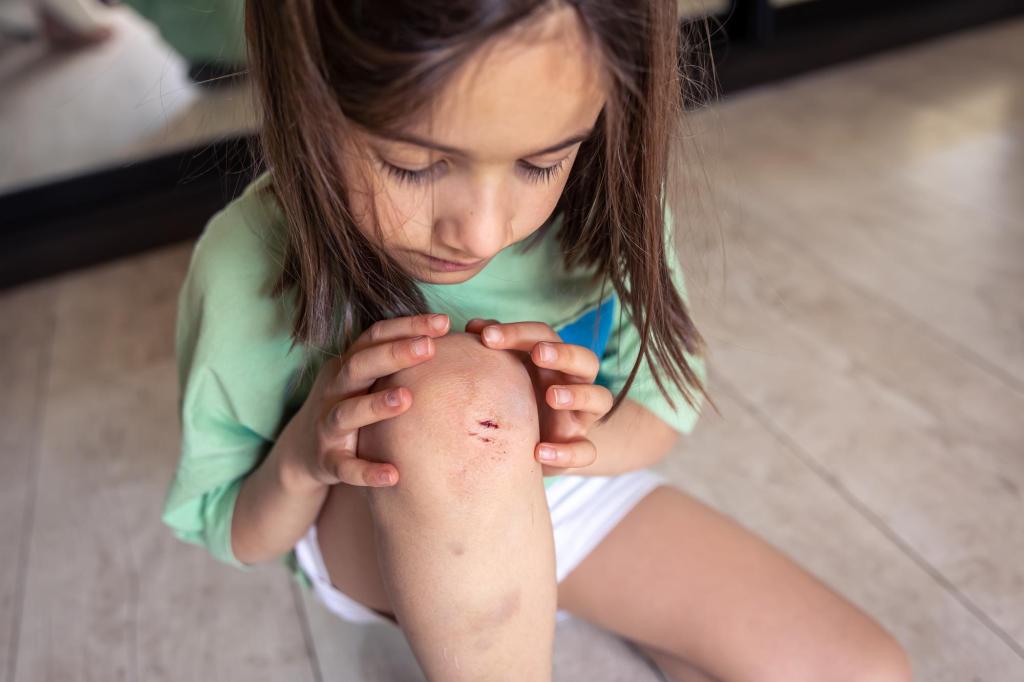 moratones en niños