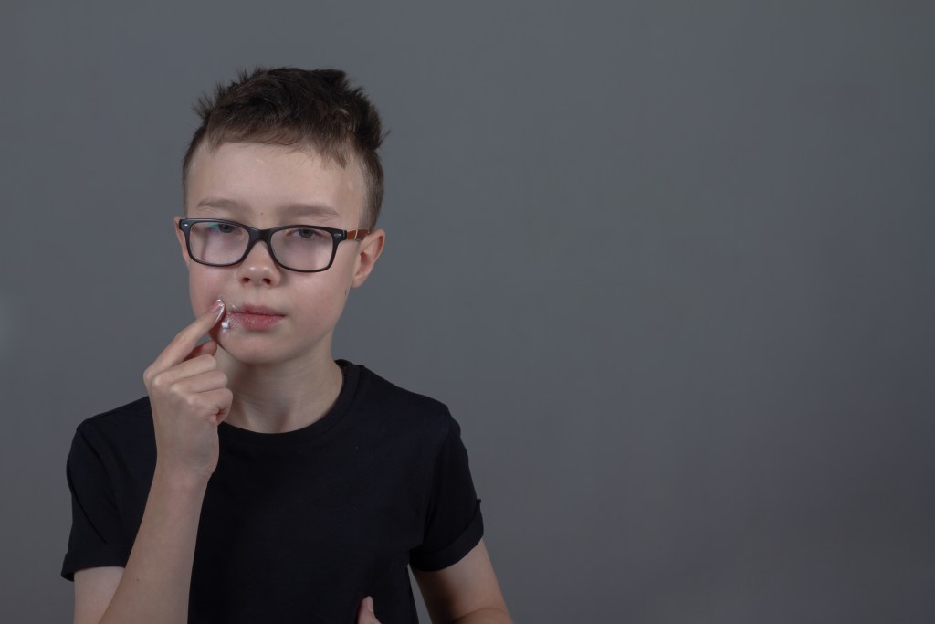 Herpes labial y nasal, ¿es la misma lesión? Un pediatra responde