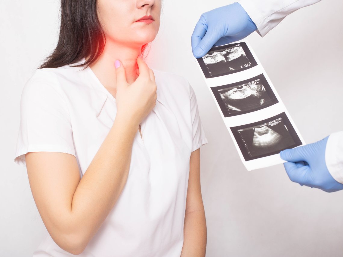 La tiroiditis autoinmune puede causar infertilidad