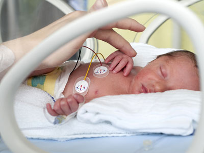 Bebés prematuros: todo sobre sus frágiles pulmones