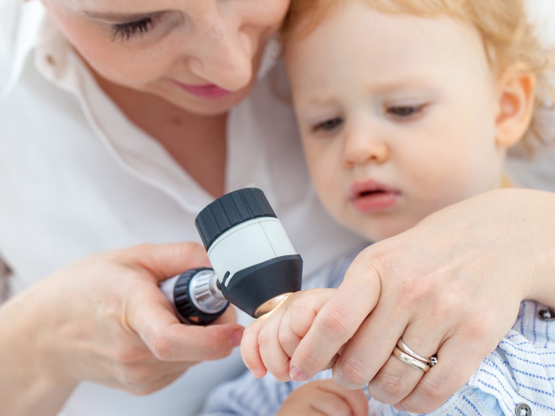 Cáncer de piel en niños