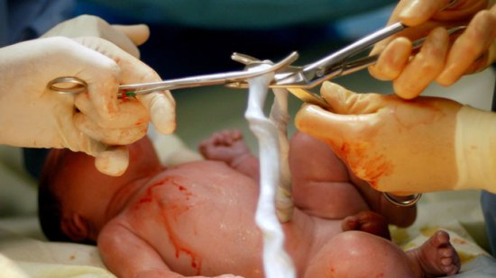 La OMS recomienda esperar 3 minutos a cortar el cordón umbilical
