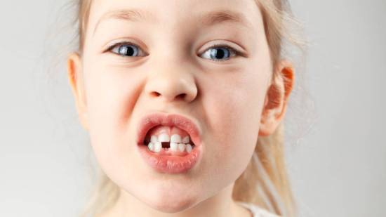 Consecuencias de arrancar un diente de leche del niño