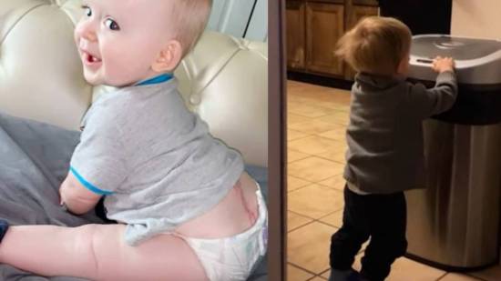 Un niño de 2 años con espina bífida aprende a caminar pese al pronóstico