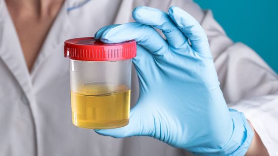 Urocultivo en el embarazo: qué es y para qué sirve