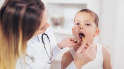 Amigdalitis bacteriana: qué es, por qué pasa y tratamiento