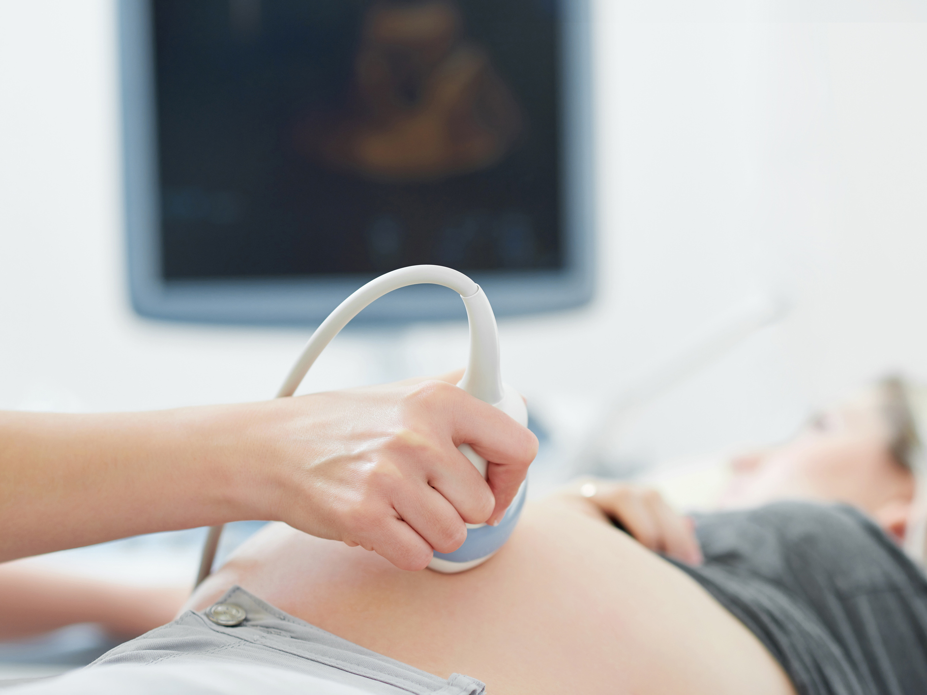 Parto inducido: preguntas frecuentes