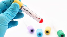 Clamidia: una causa de infertilidad