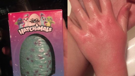 ¡Cuidado con los productos con los que bañamos a los pequeños!
