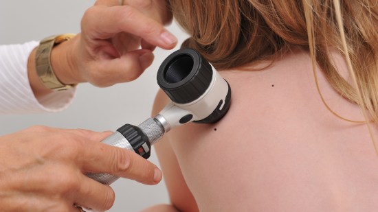 Moluscos contagiosos en la piel de los niños: qué son y cómo tratarlos