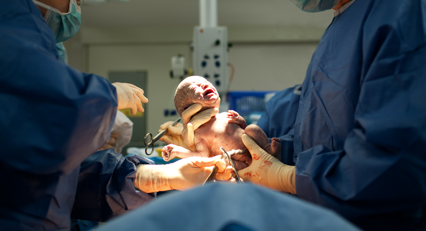 Riesgos de una cesárea para la madre y para el bebé