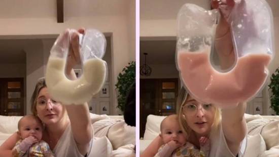 Una mujer enseña su leche materna de color rosa: ¿cómo es posible?