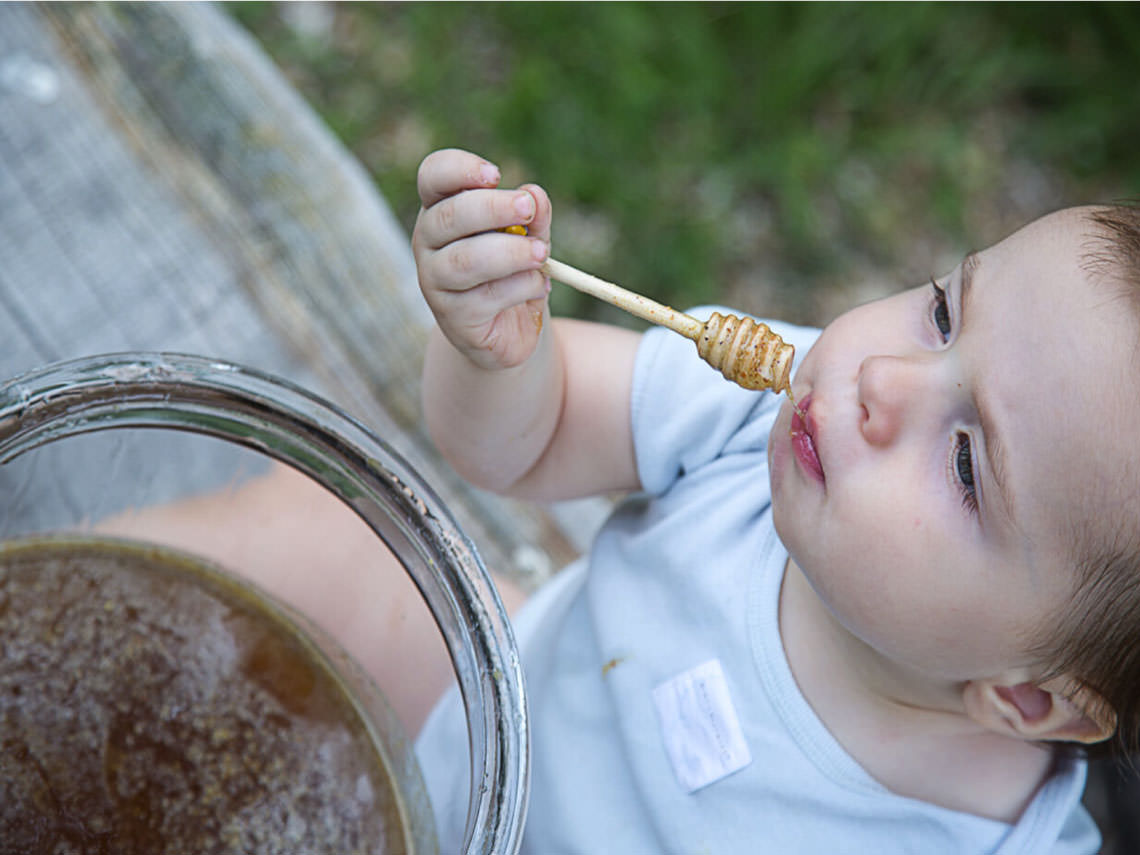 Botulismo infantil