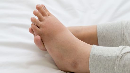 Cómo reducir la hinchazón en los pies durante el embarazo