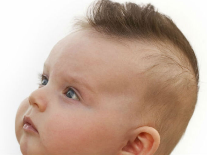 El pelo del bebé A