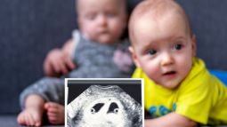 ¿Qué es la superfertilización? Cuáles son las causas de la superfecundación heteropaternal