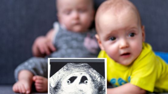 ¿Qué es la superfertilización? Cuáles son las causas de la superfecundación heteropaternal