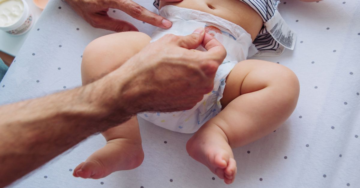 Mi bebé tiene el culete rojo: la dermatitis del pañal