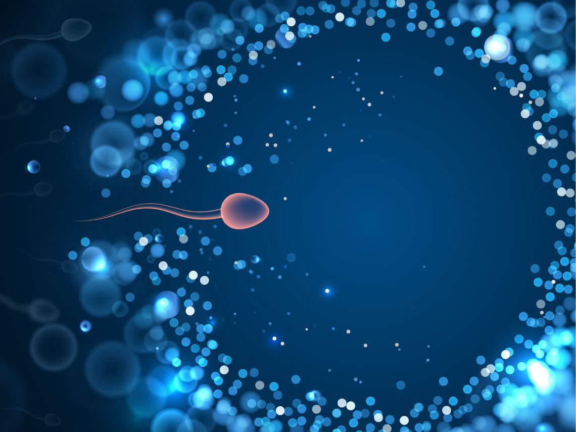 Azoospermia