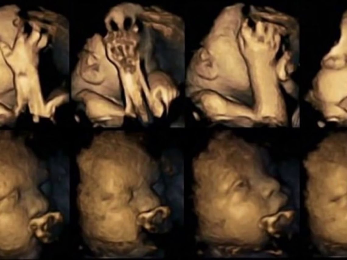 Así son las caras de un bebé en el vientre materno cuando su madre fuma
