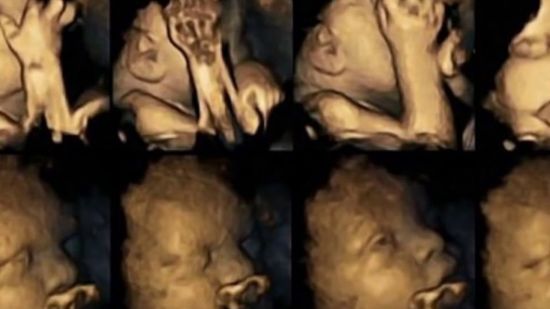 Así son las caras de un bebé en el vientre materno cuando su madre fuma