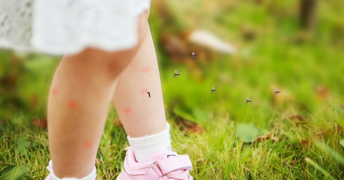 ¿Cómo calmar el picor de las picaduras de mosquitos en niños?