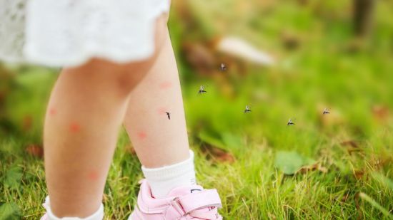 ¿Cómo calmar el picor de las picaduras de mosquitos en niños?