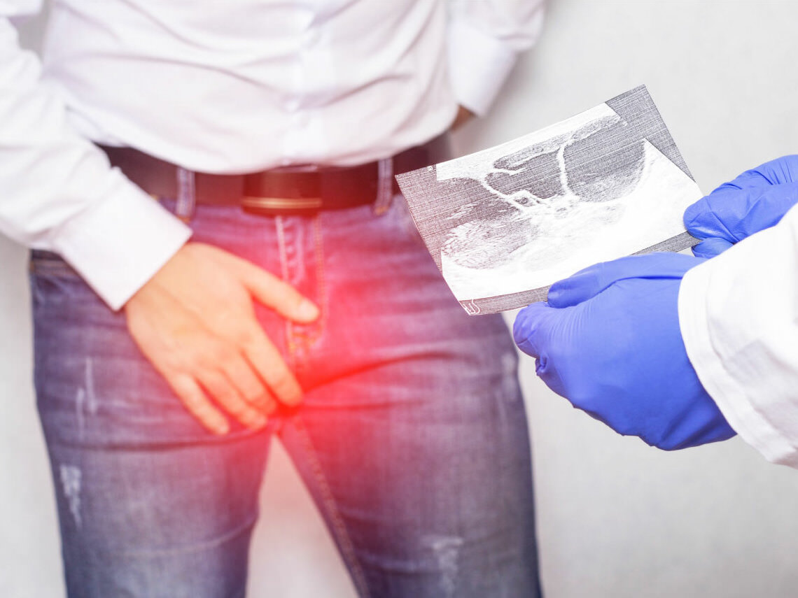 Ecografía testicular