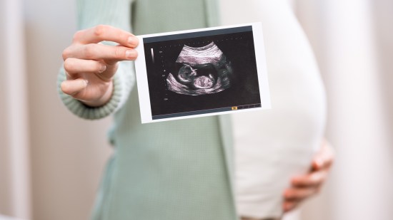 ¿Es posible conocer el sexo del bebé en la primera ecografía?