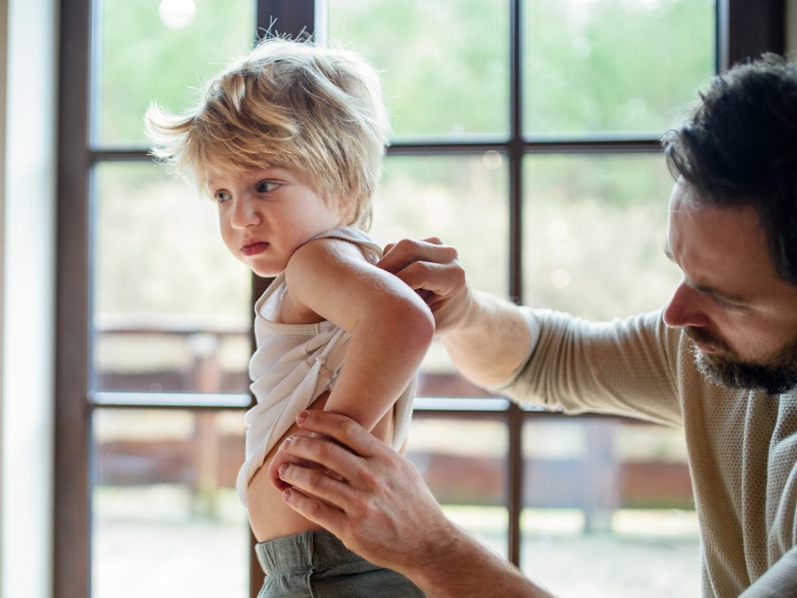 Problemas frecuentes en la piel de los niños