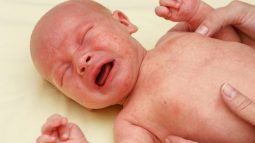 Petequias en el bebé: causas, síntomas y tratamiento