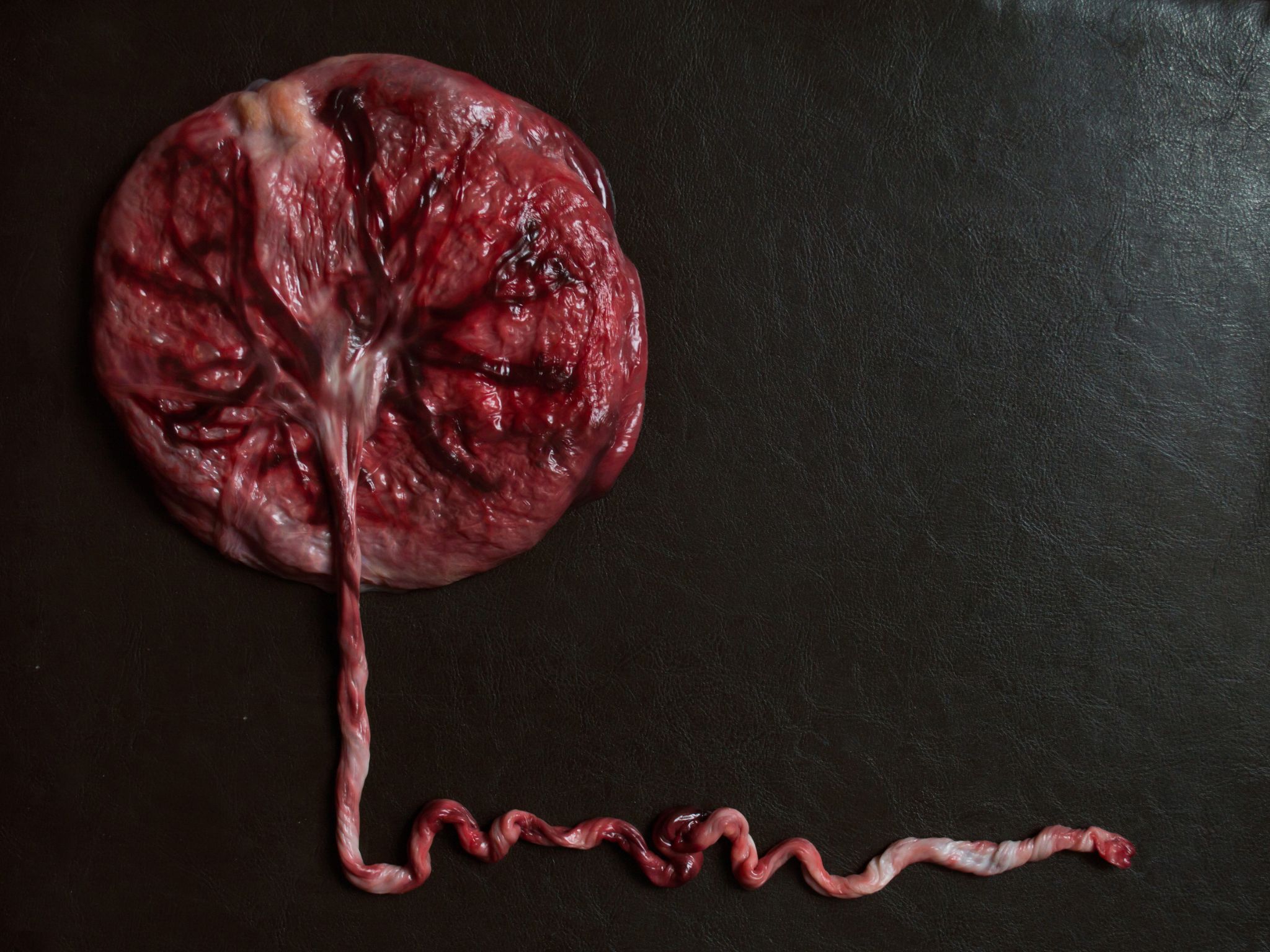 los riesgos de ingerir la placenta