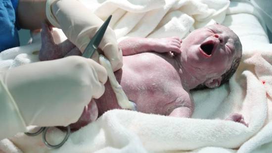 Prolapso de cordón umbilical: causas y riesgos