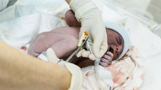 Cómo cortar el cordón umbilical y qué precauciones se deben tener