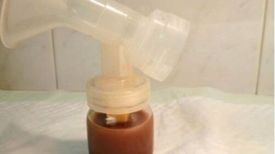 Síndrome de las tuberías oxidadas