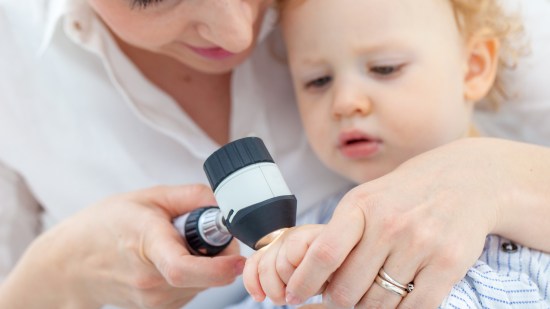 cáncer de piel niños