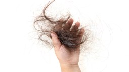 caida pelo