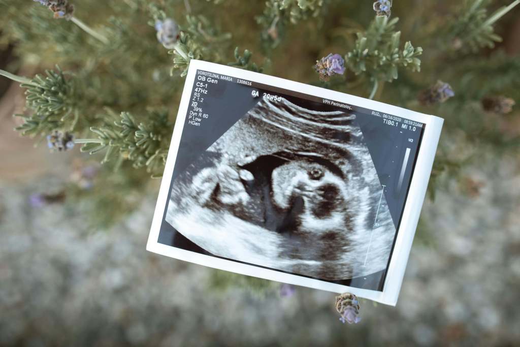 Frecuencia cardíaca fetal: guía completa para padres primerizos - Pexels