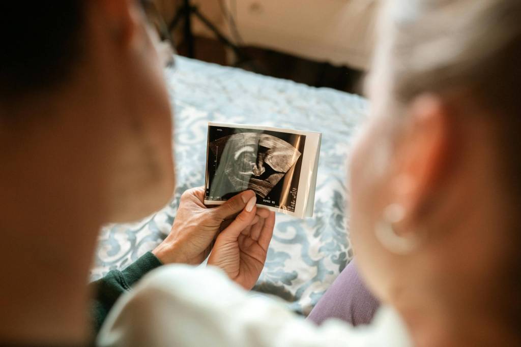 Desde qué semana es posible escuchar el latido del corazón del bebé -  Pexels