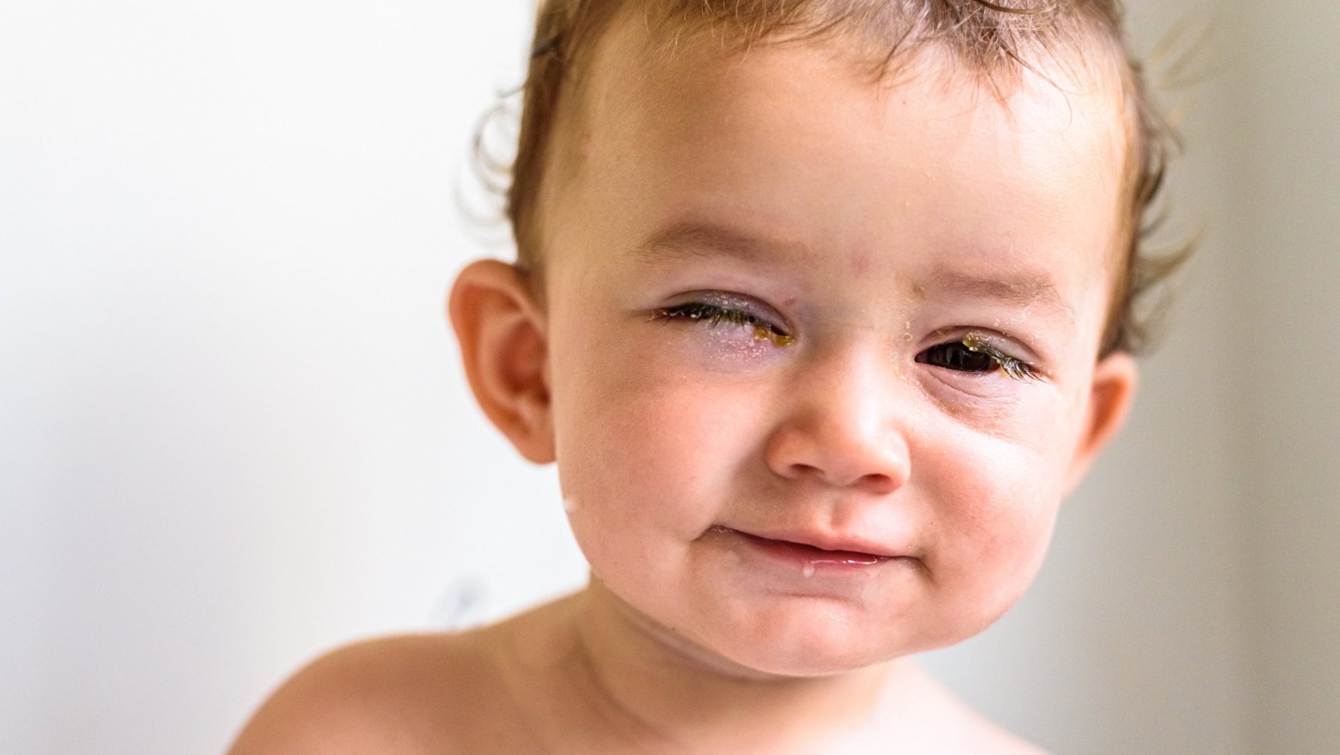 Legañas en recién nacidos: consejos para cuidar los ojos de tu bebé