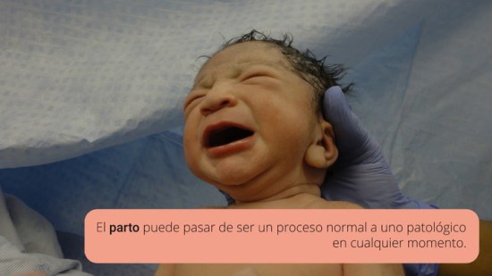 ¿Qué pasa si el parto se detiene?