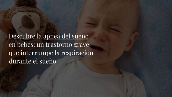 Apnea del sueño en bebés: causas, síntomas y tratamiento