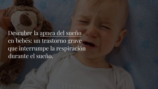 Apnea del sueño en bebés: causas, síntomas y tratamiento