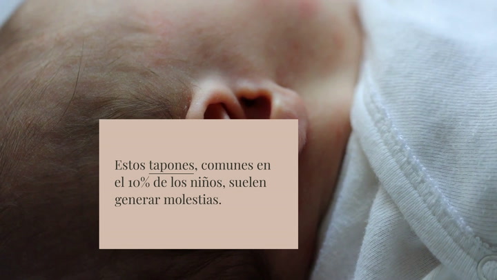 Qué hacer si mi hijo tiene tapones de cera