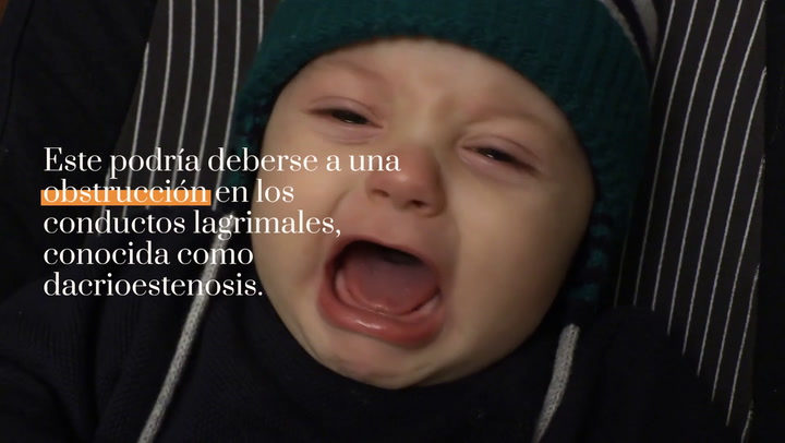 Mi bebé tiene los ojos llorosos
