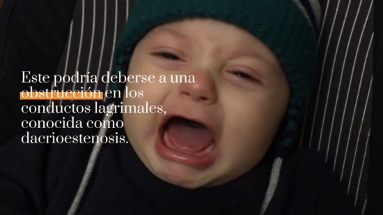 Mi bebé tiene los ojos llorosos