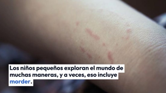 ¡Mi hijo muerde! Cómo actuar ante los mordiscos en niños