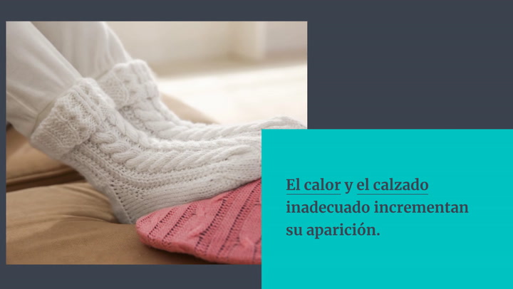Durezas en los pies: cómo tratarlas