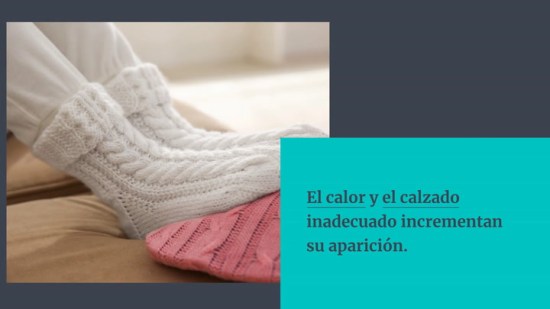 Durezas en los pies: cómo tratarlas